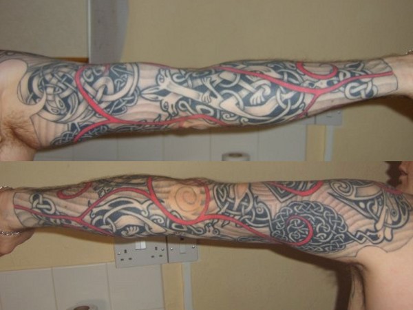 Jason - left arm