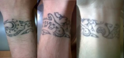 Patxi - Polynesian: real inked placement tattoo photo thumbnail